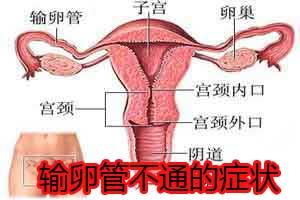人流后输卵管不通的症状是什么