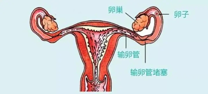 如何证明输卵管是通的?郑州不孕不育医院为你解答!